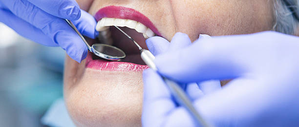 Best Emergency Dental Care for Broken or Chipped Teeth in Bigfork, MT